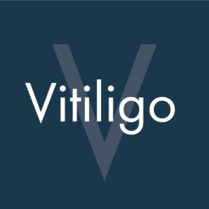 Vitiligo